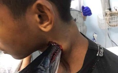 Needlefish impales teenager!