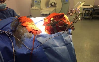 DBS brain surgery could get me surfing again!