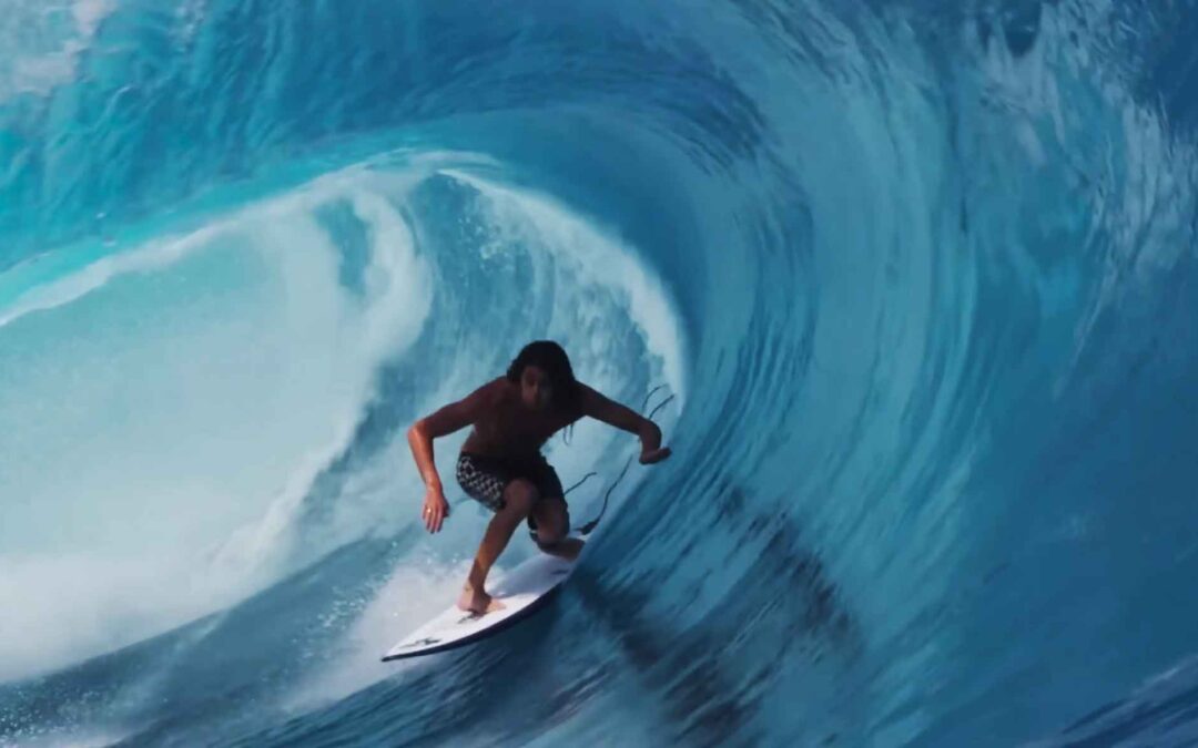 Craig Anderson