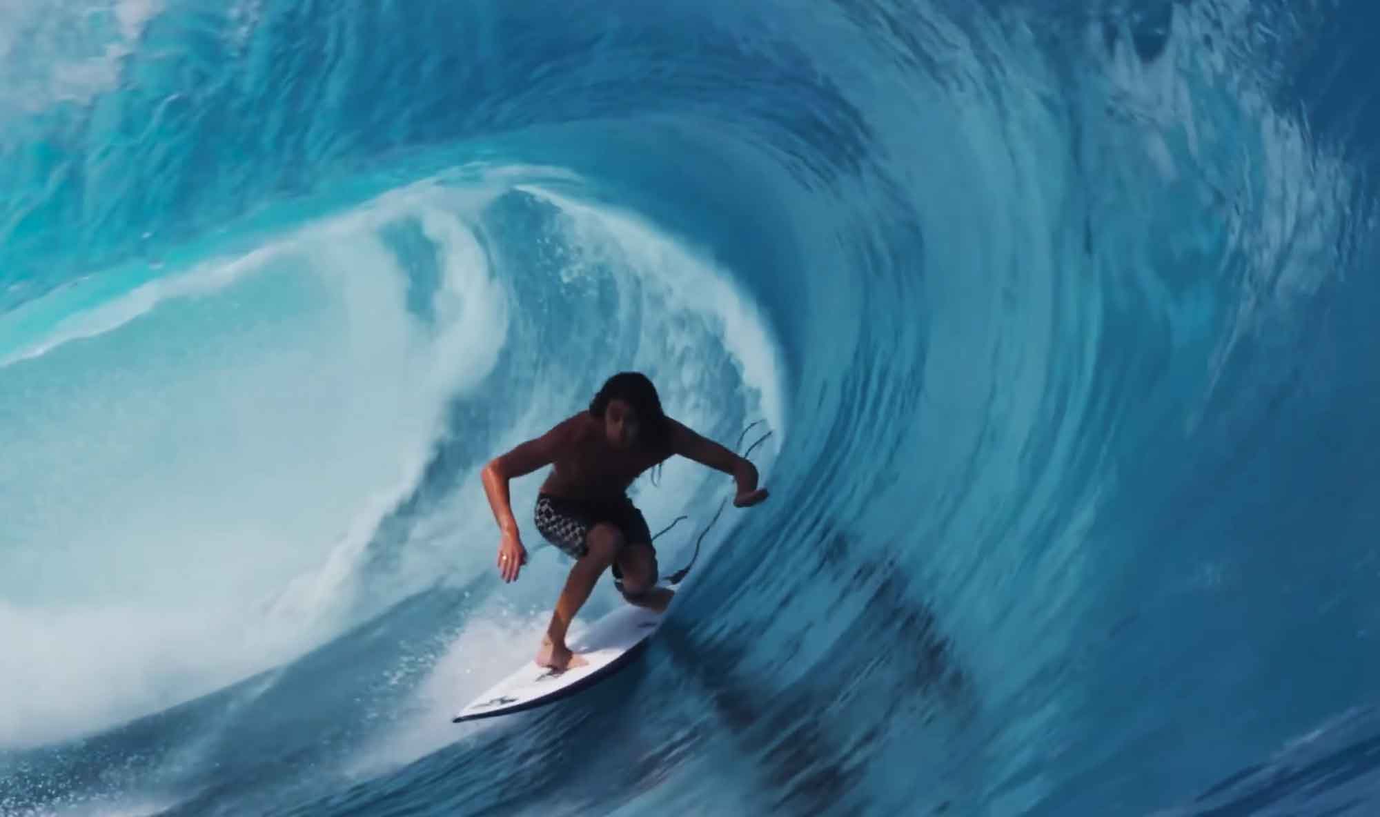 Craig Anderson
